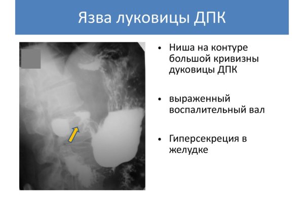 Кракен регистрация